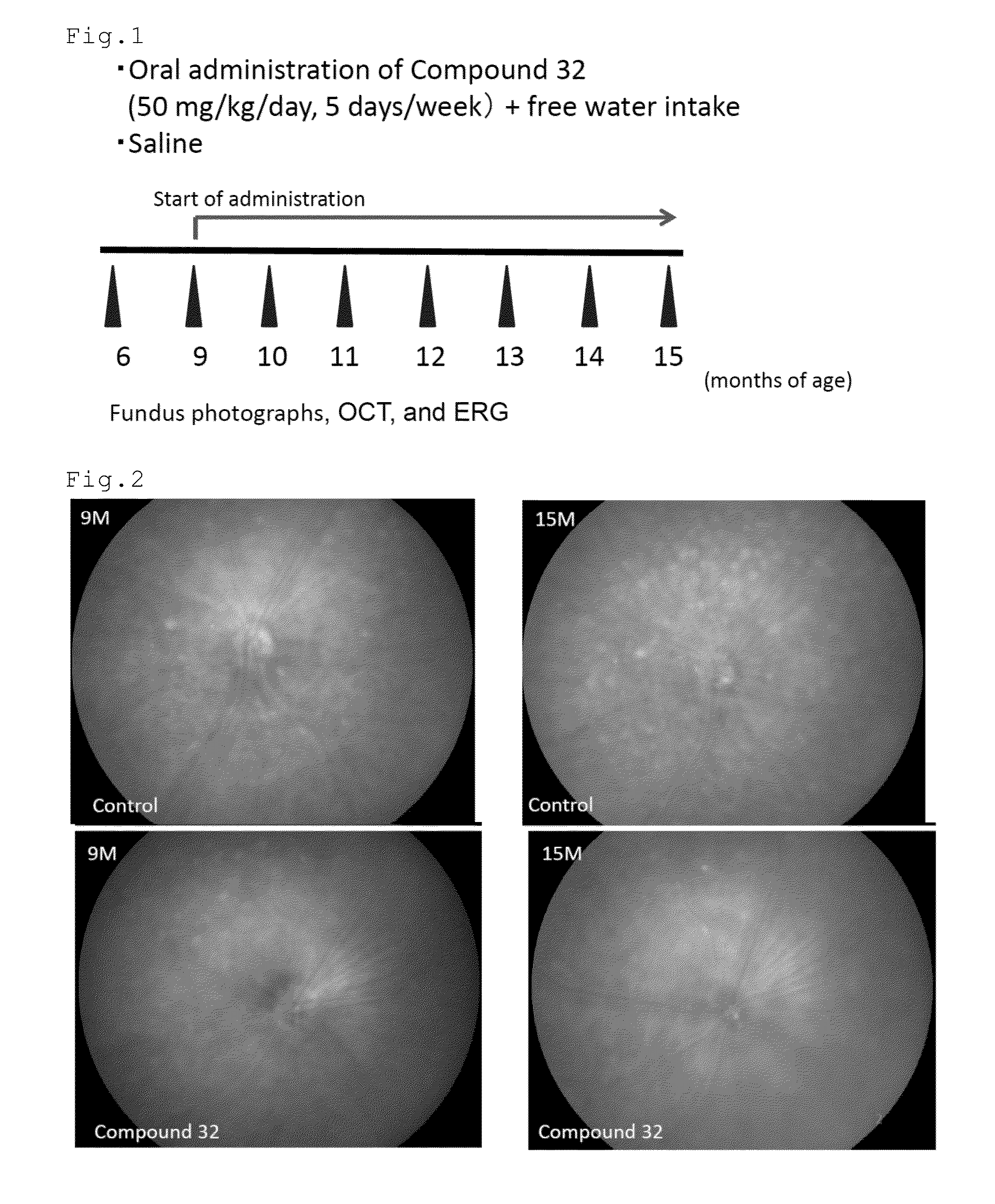 Method For Treating Eye Diseases