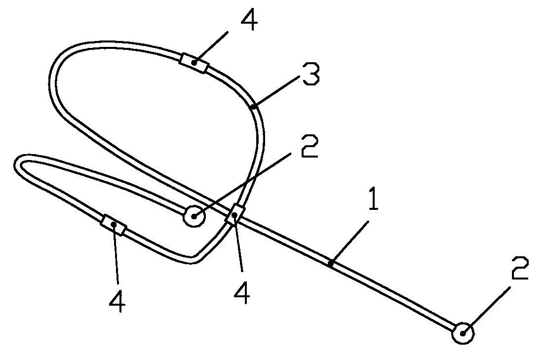 Anatomical lung volume reduction elastic bracket