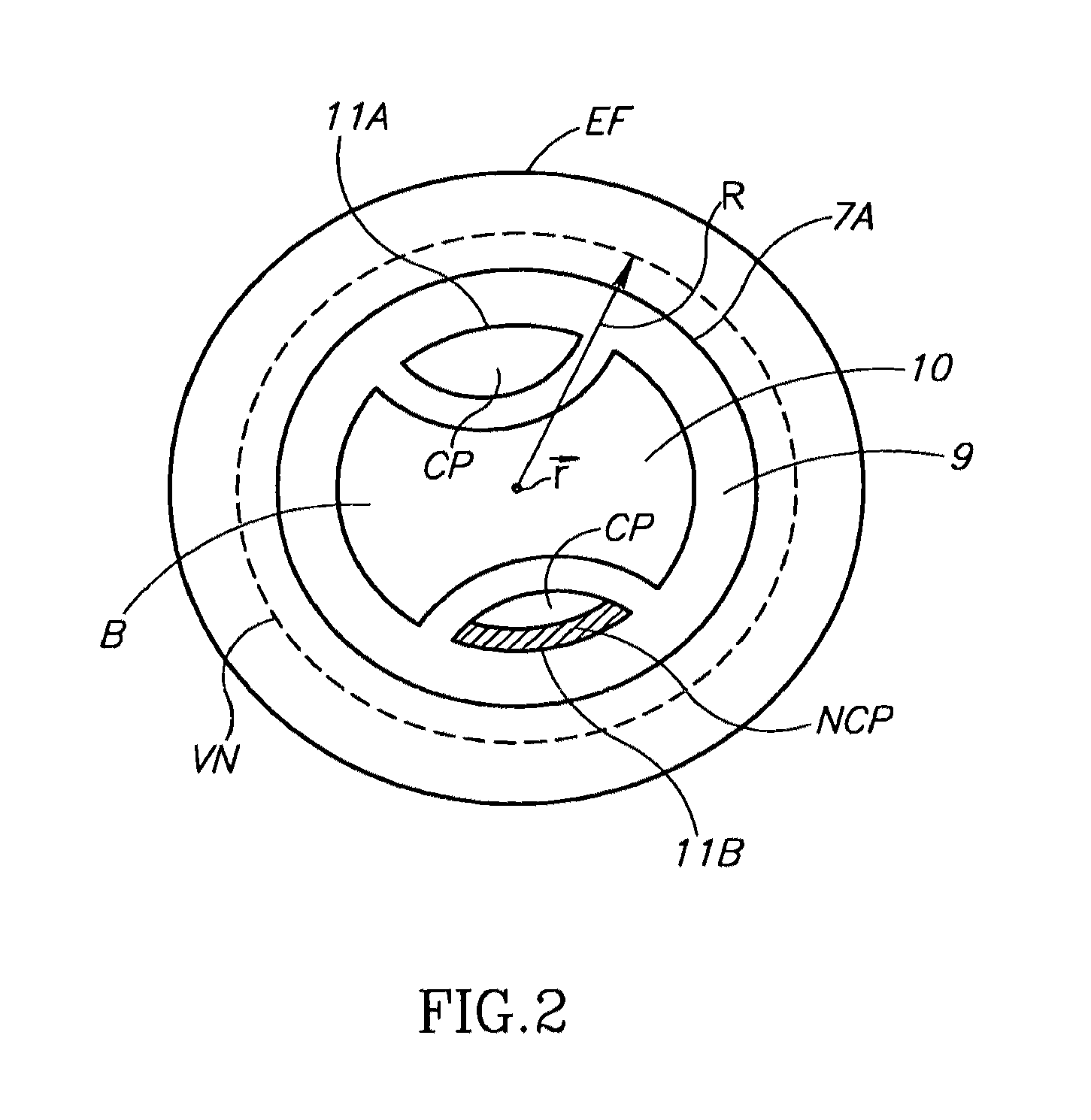 Method and system for plaque characterization