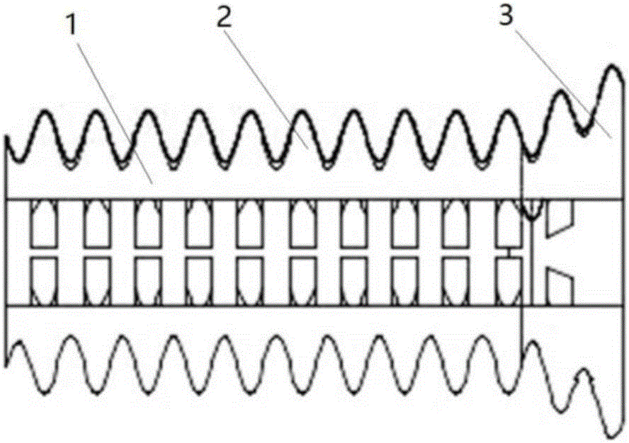 3D (three-dimensional) printing degradable trachea outer stent for treating tracheostenosis and manufacturing method thereof