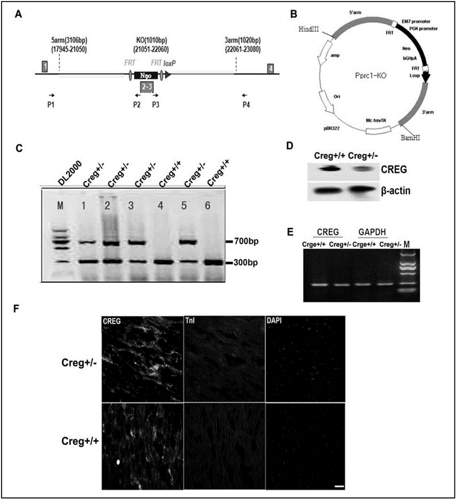 Medical application of CREG protein in preventing or treating myocardial infarction