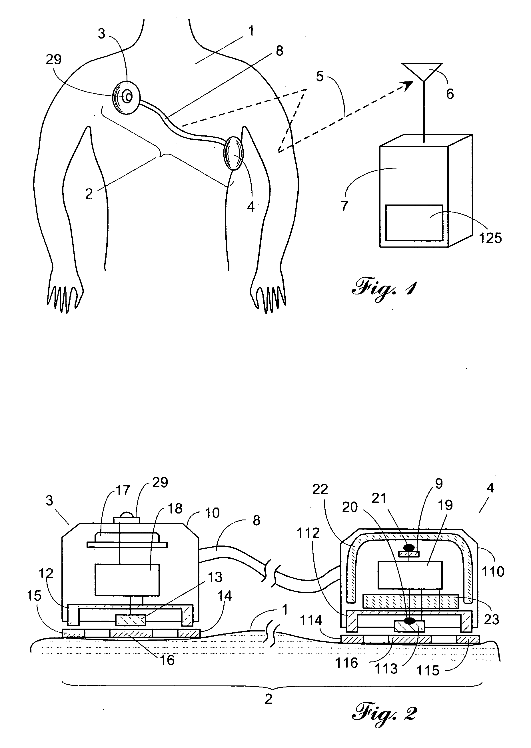 Wireless medical probe