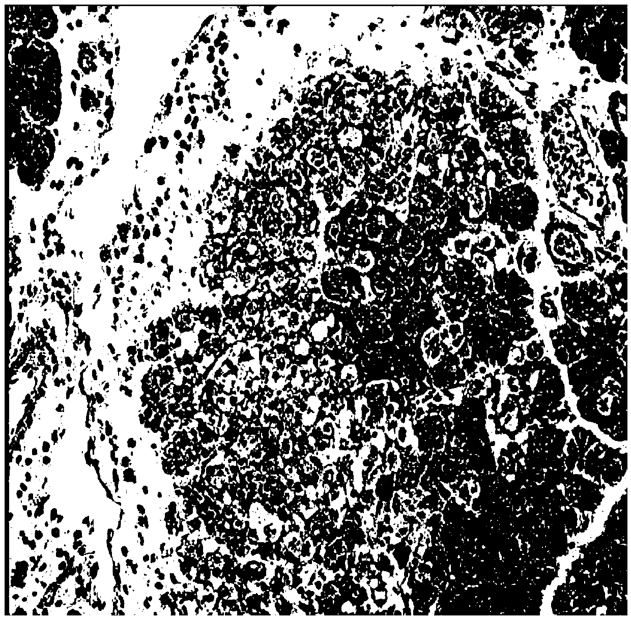 Application of pyrazolopyrimidine derivative for treating acute pancreatitis