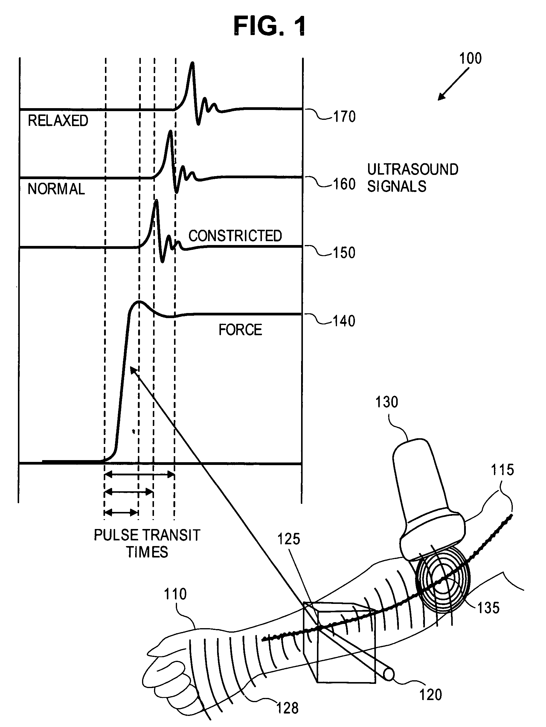 Arterial endothelial function measurement method and apparatus