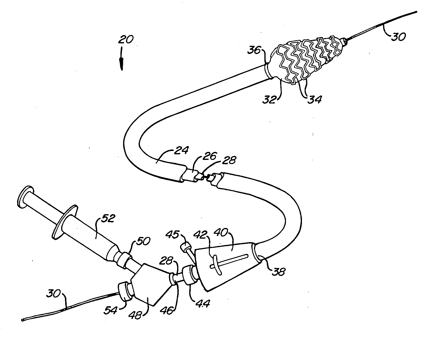 Stent deployment systems and methods