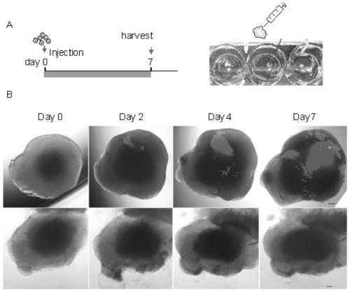 Construction method and application of glioblastoma organ model