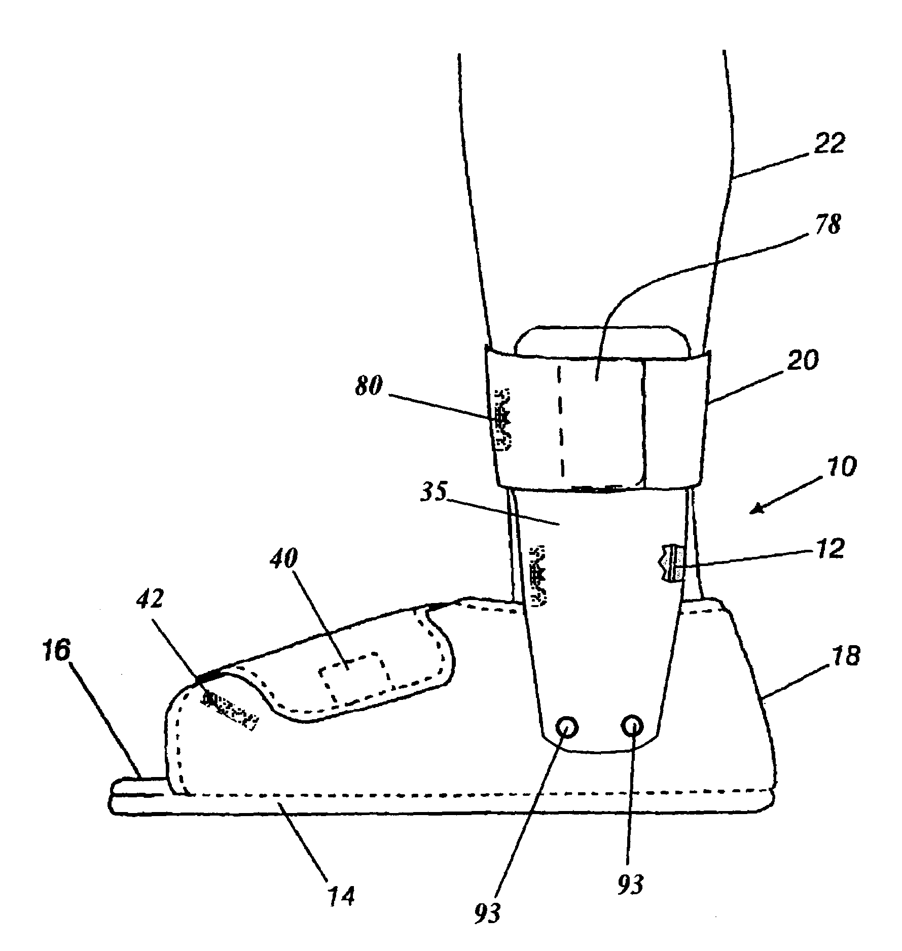 Orthopedic night foot splint