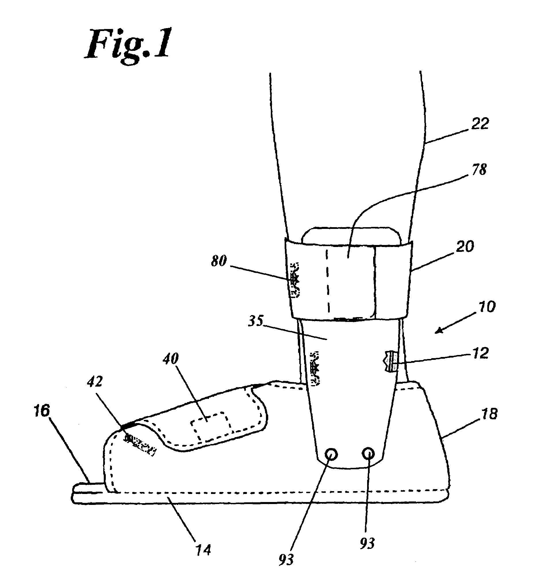 Orthopedic night foot splint