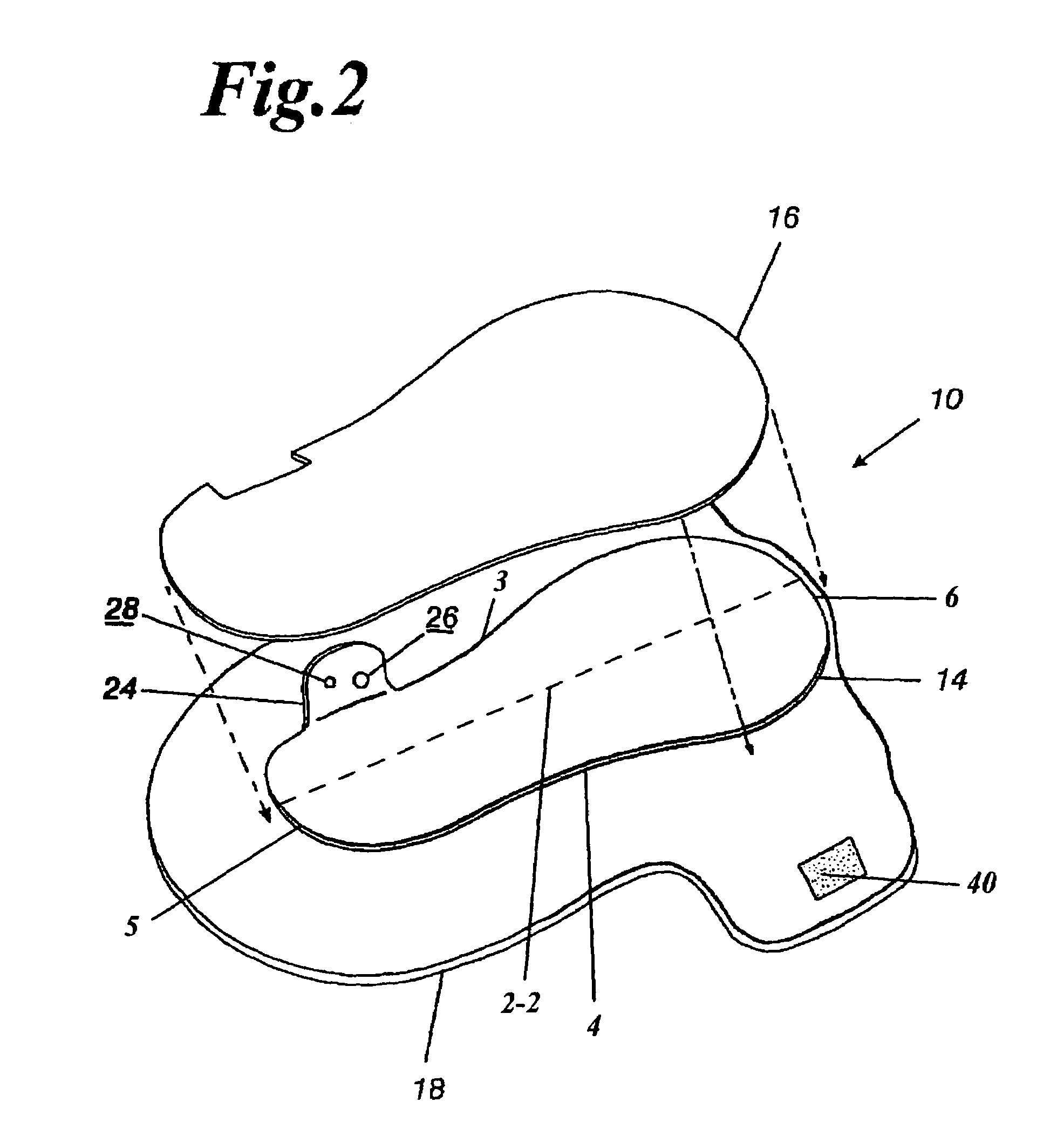 Orthopedic night foot splint