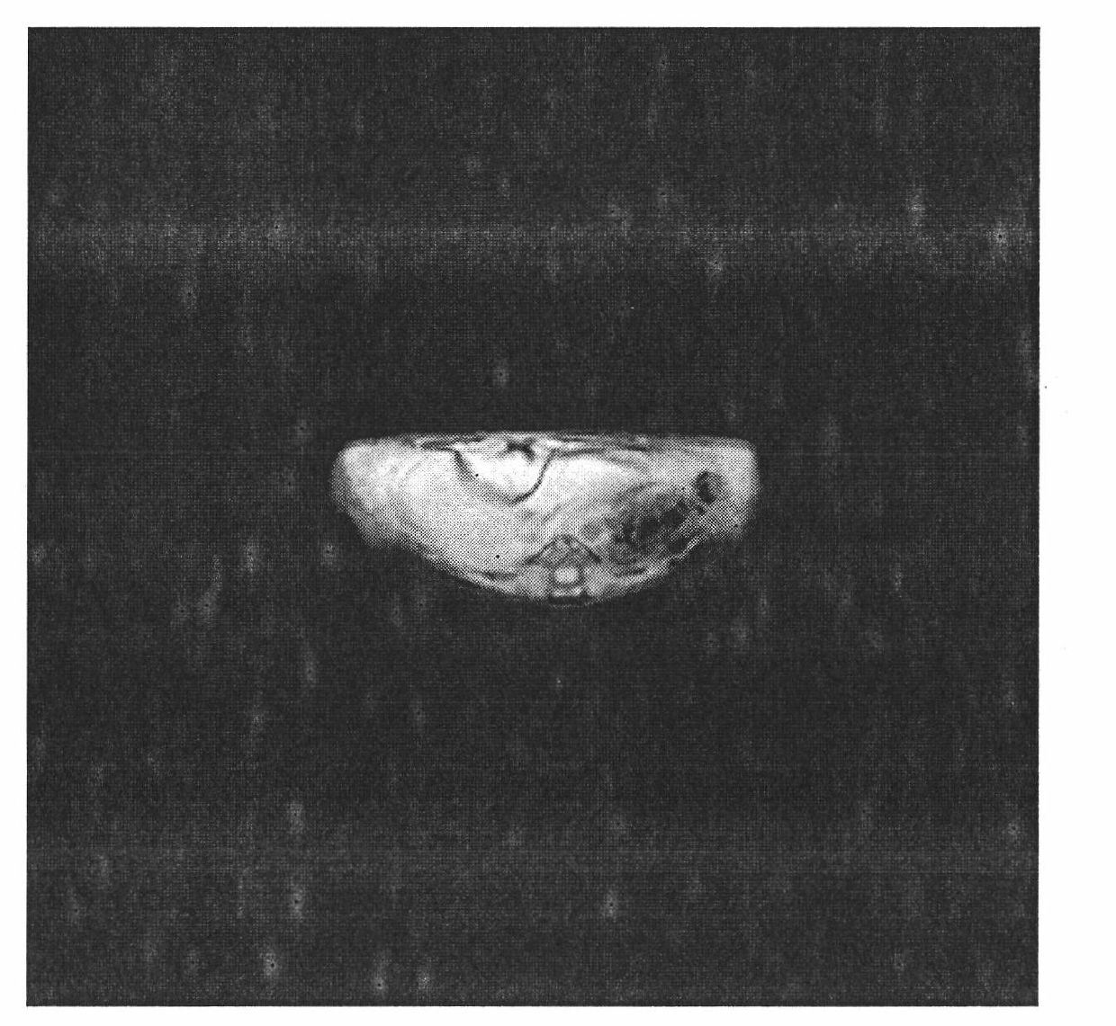 Contrast medium of dual-sector targeted magnetic resonance imaging contrast and preparation thereof