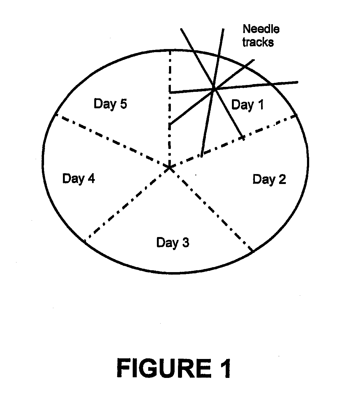 Methods for Treating Cancer Using an Immunotoxin