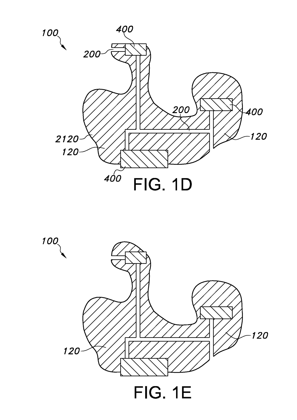 Making 3D printed shapes with interconnects and embedded components