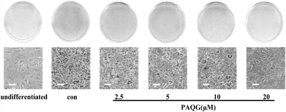 Compound-pyrocincholic acid 3beta-O-beta-D-quinovopyranosyl-28-O-beta-D-glucopyranoside (PAQG) for adjusting lipid metabolism and obesity as well as application of compound in pharmacy