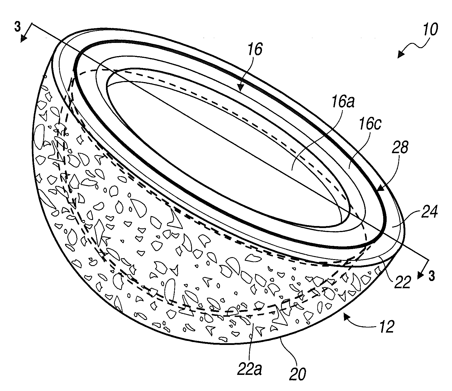 System and Method for Acetabular Cup