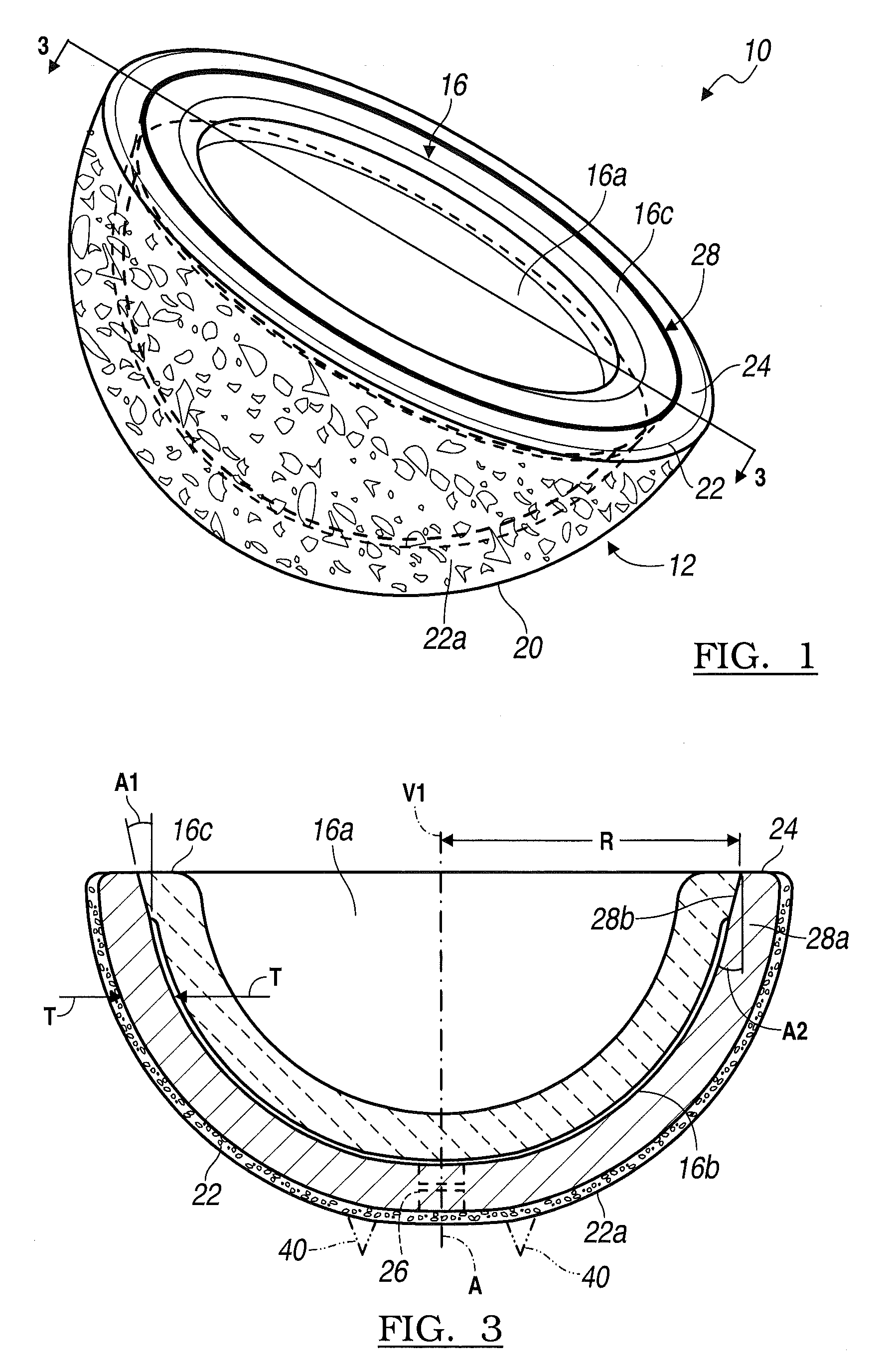 System and Method for Acetabular Cup