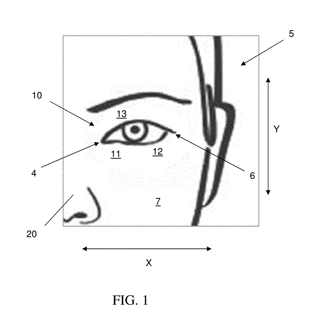 Products and methods for treating periorbital dyschromia