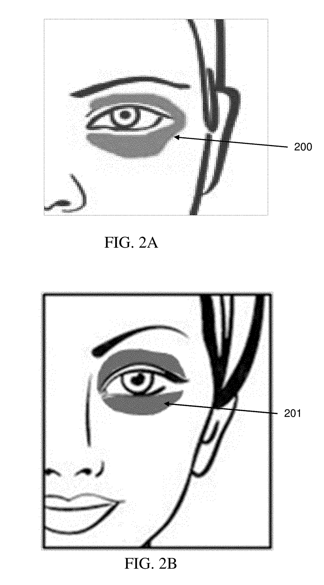 Products and methods for treating periorbital dyschromia