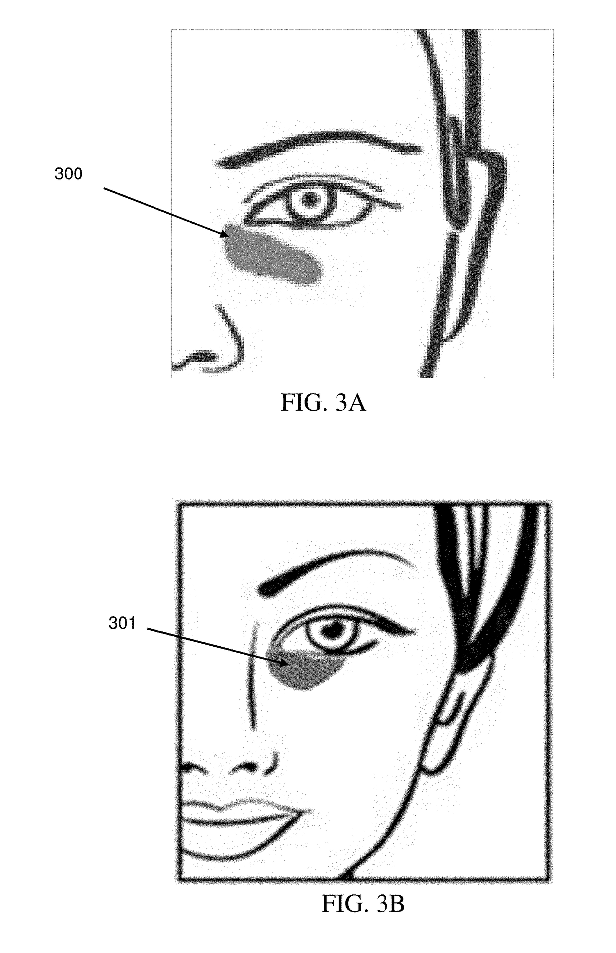 Products and methods for treating periorbital dyschromia