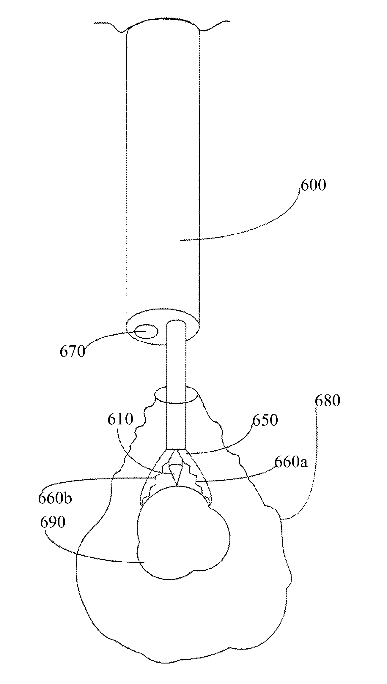 Thermally adjustable surgical tool, balloon catheters and sculpting of biologic materials