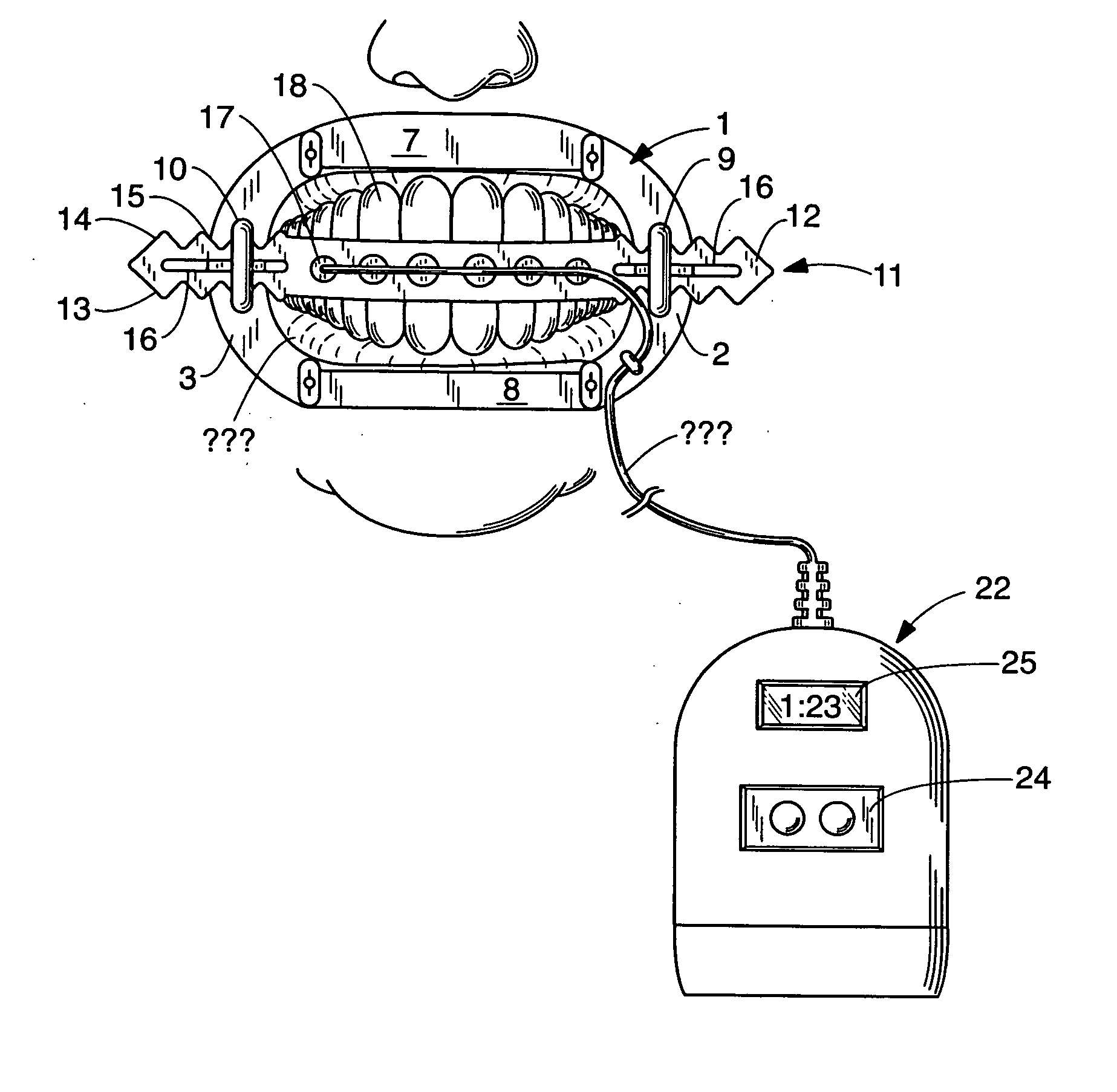 Tooth whitening device