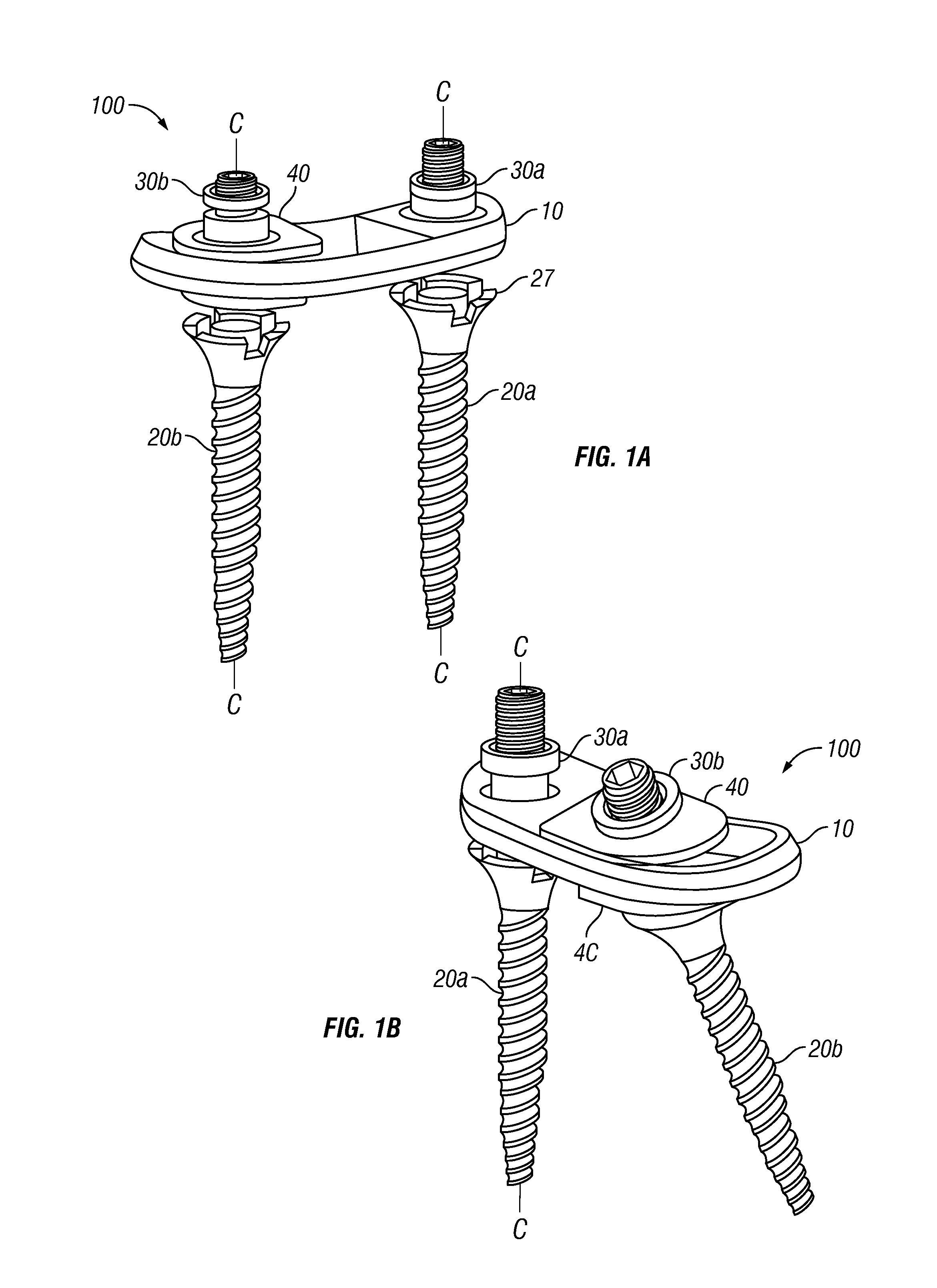 Posterior Lumbar Plate