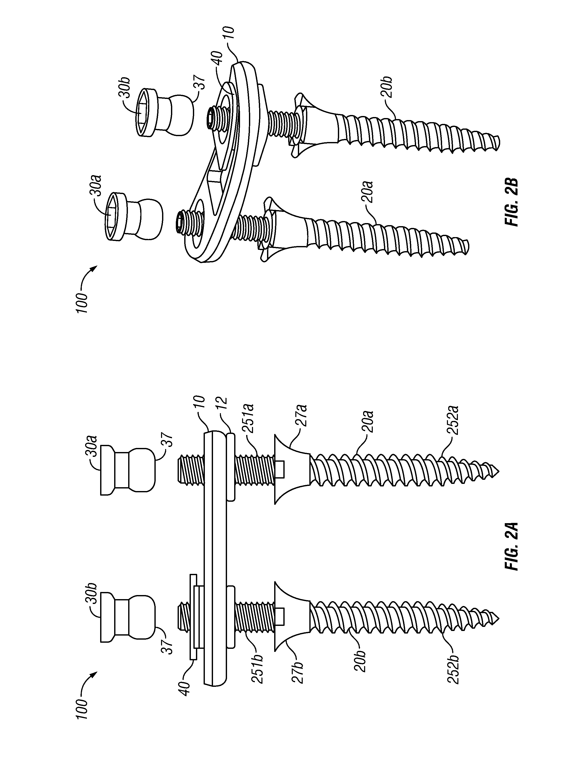 Posterior Lumbar Plate