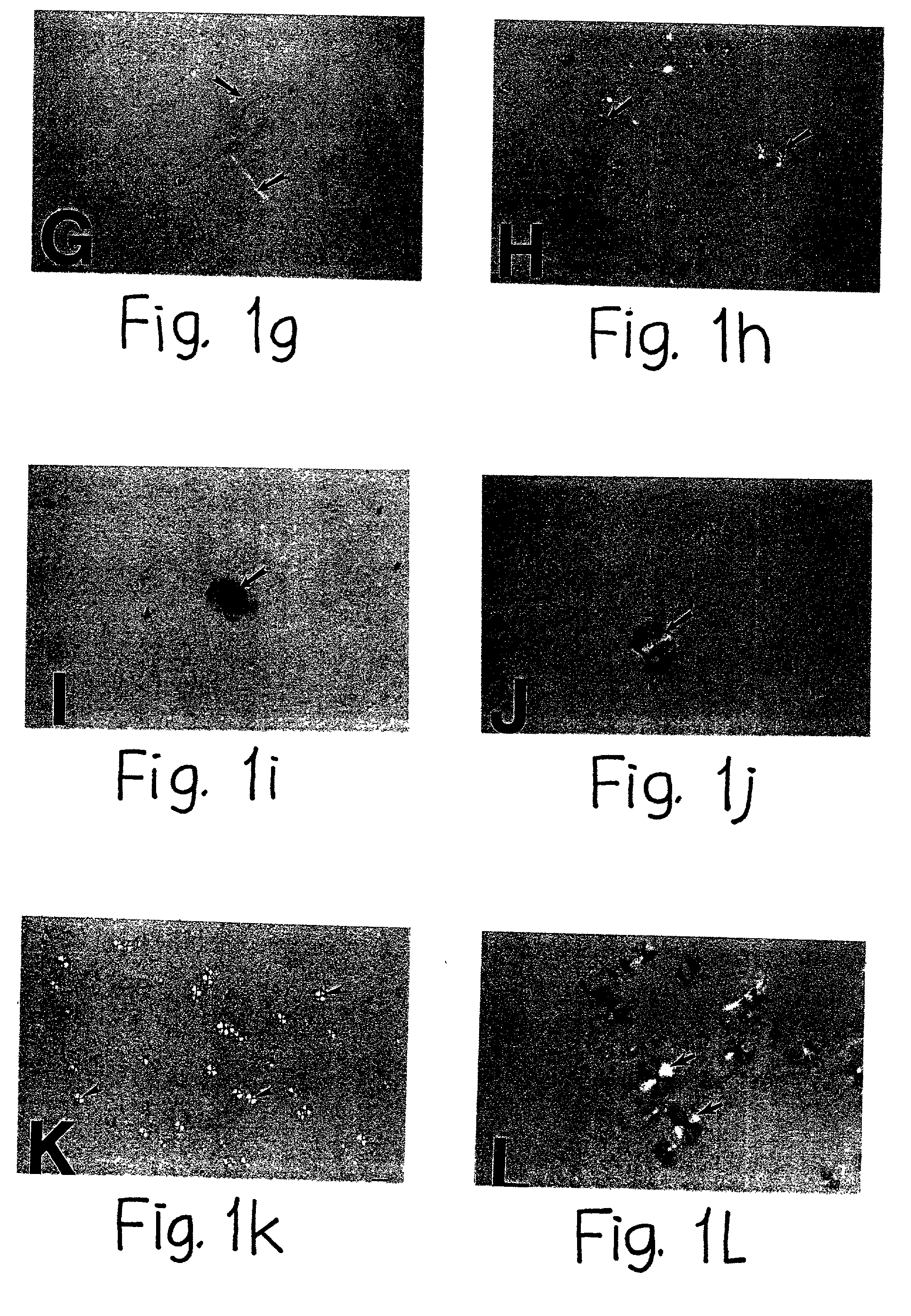 <i>In vitro </i>formation of congophilic maltese-cross amyloid plaques to identify anti-plaque therapeutics for the treatment of Alzheimer's and Prion diseases