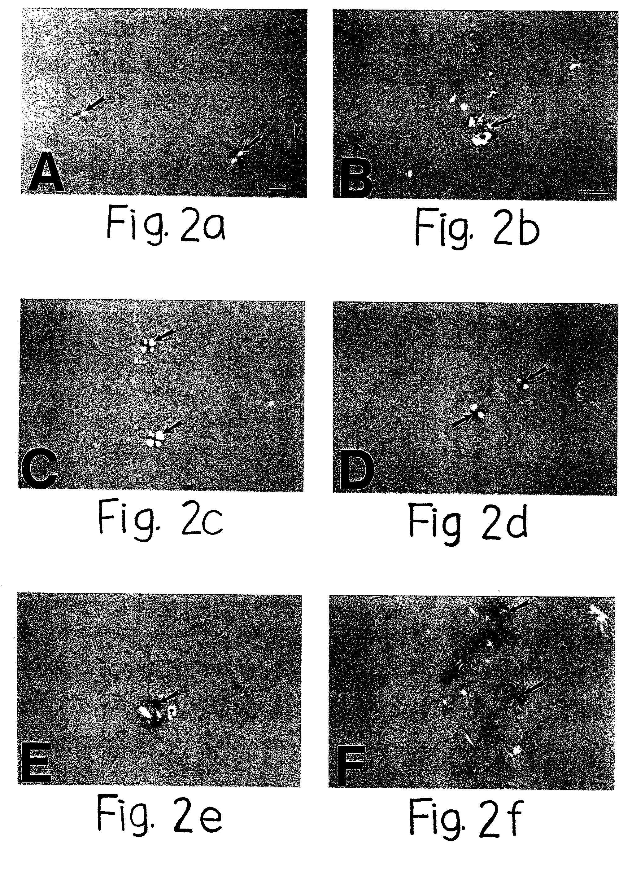 <i>In vitro </i>formation of congophilic maltese-cross amyloid plaques to identify anti-plaque therapeutics for the treatment of Alzheimer's and Prion diseases