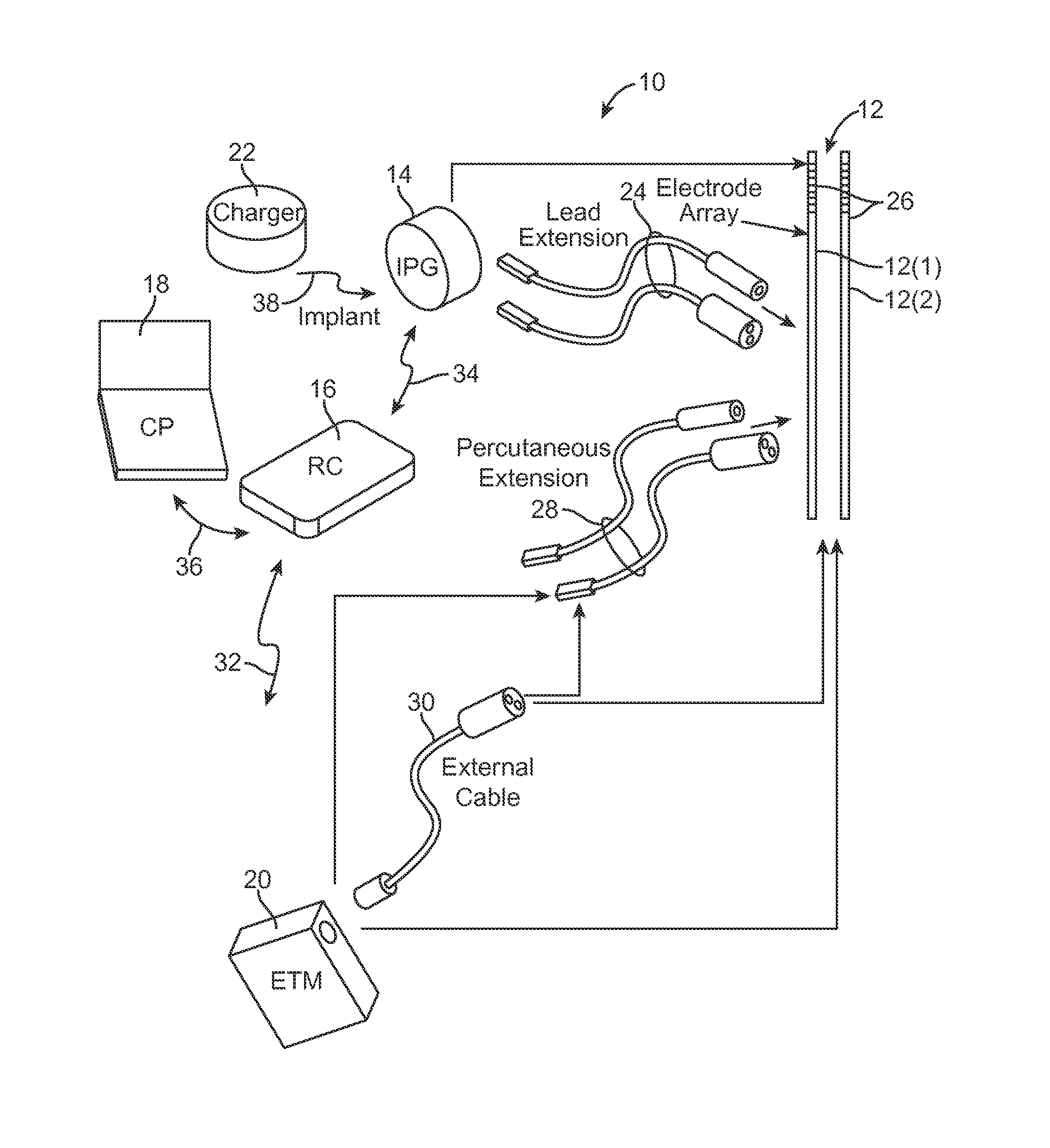 Systems and methods of providing modulation therapy without patient-perception of stimulation