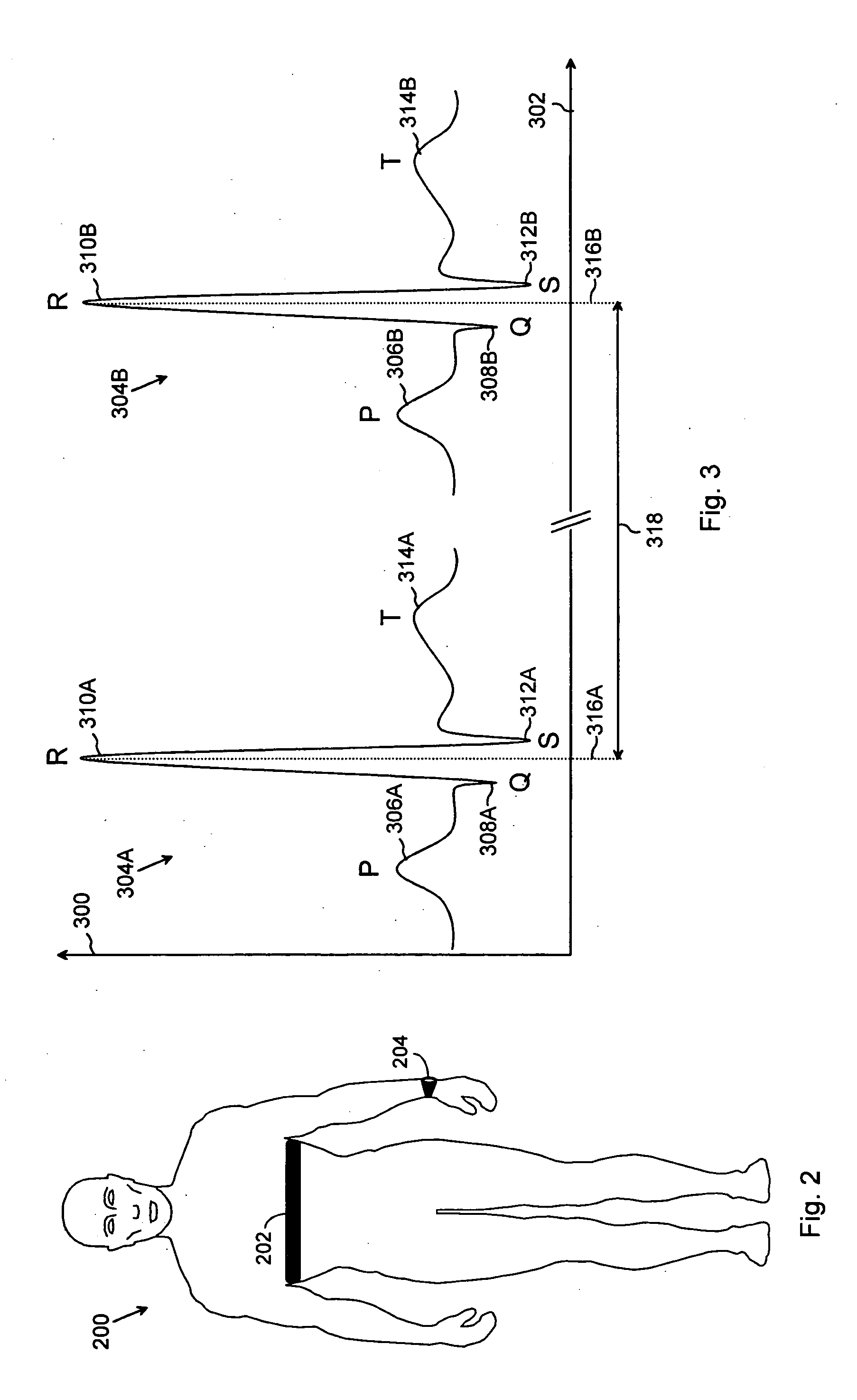 Method of monitoring human relaxation level, and user-operated heart rate monitor