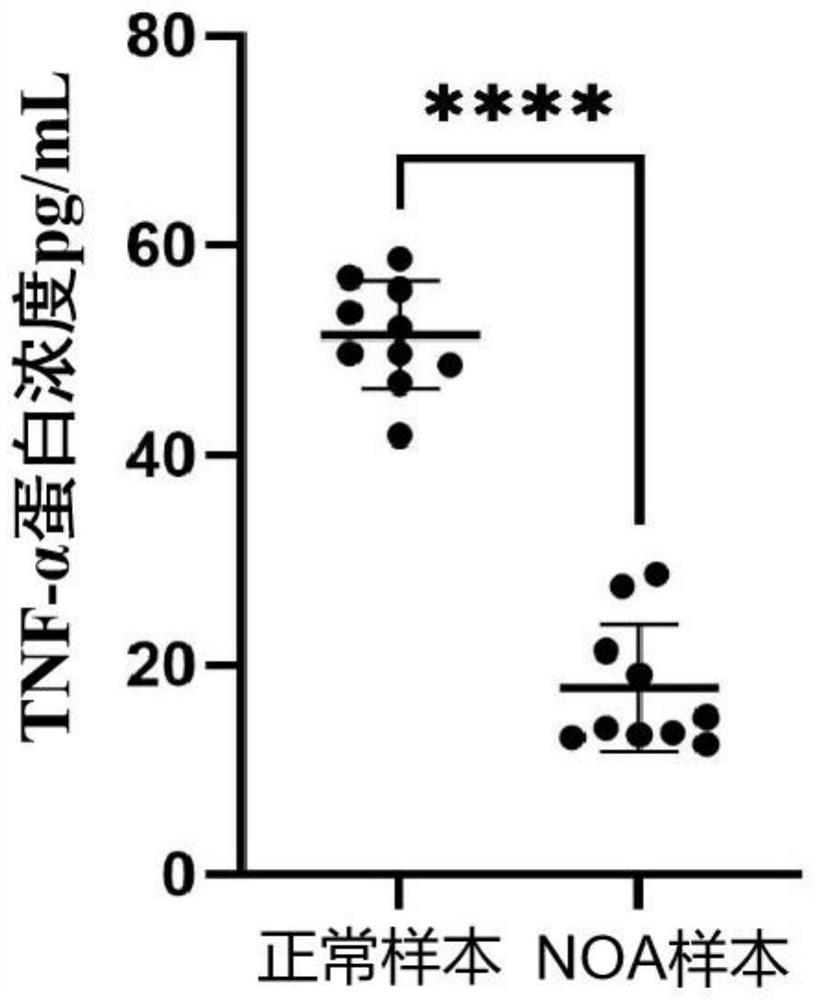 Biomarker for detecting non-obstructive azoospermia and application thereof