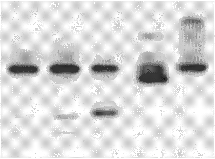 Primers and kit for detecting rare type beta-thalassemia mutation