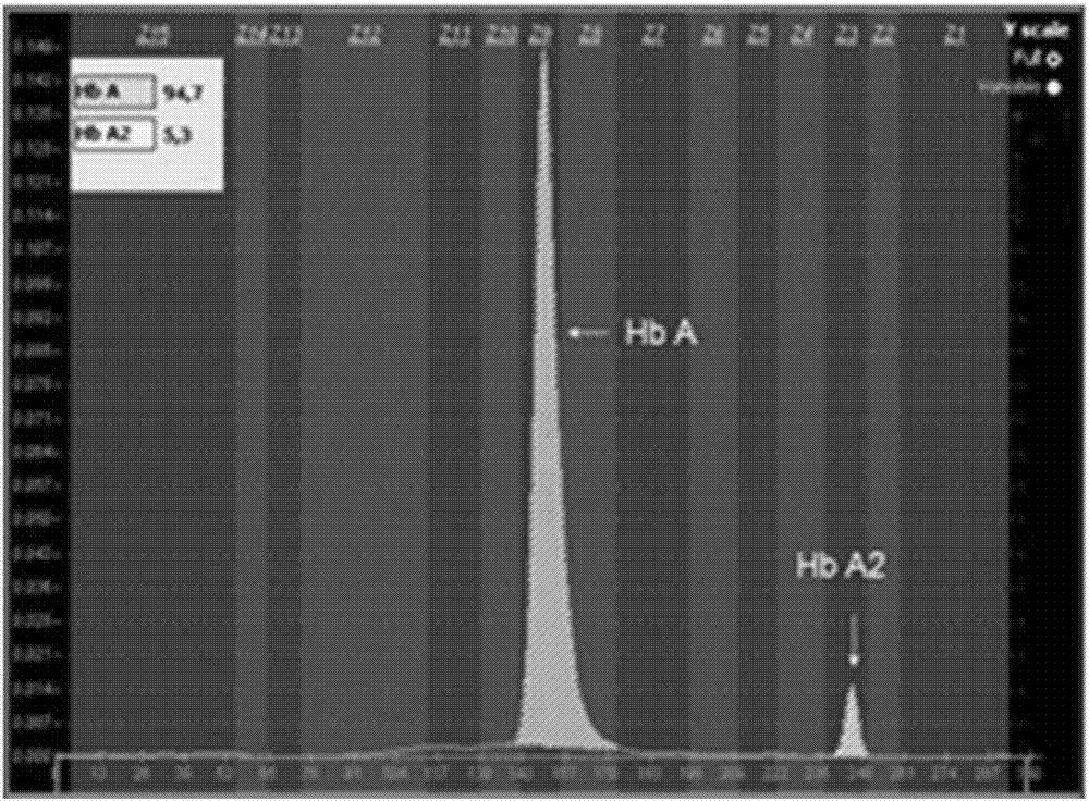 Primers and kit for detecting rare type beta-thalassemia mutation