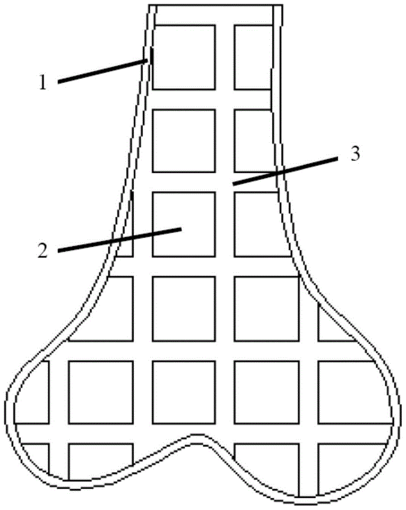 A kind of personalized customized porous tantalum implant and preparation method thereof