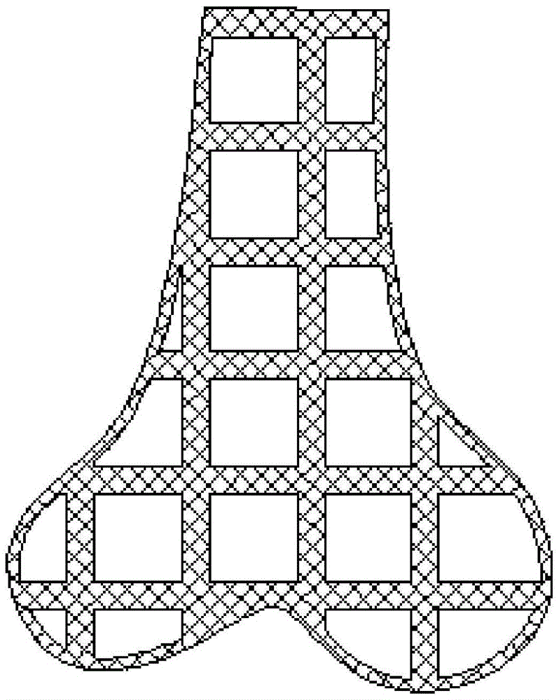 A kind of personalized customized porous tantalum implant and preparation method thereof