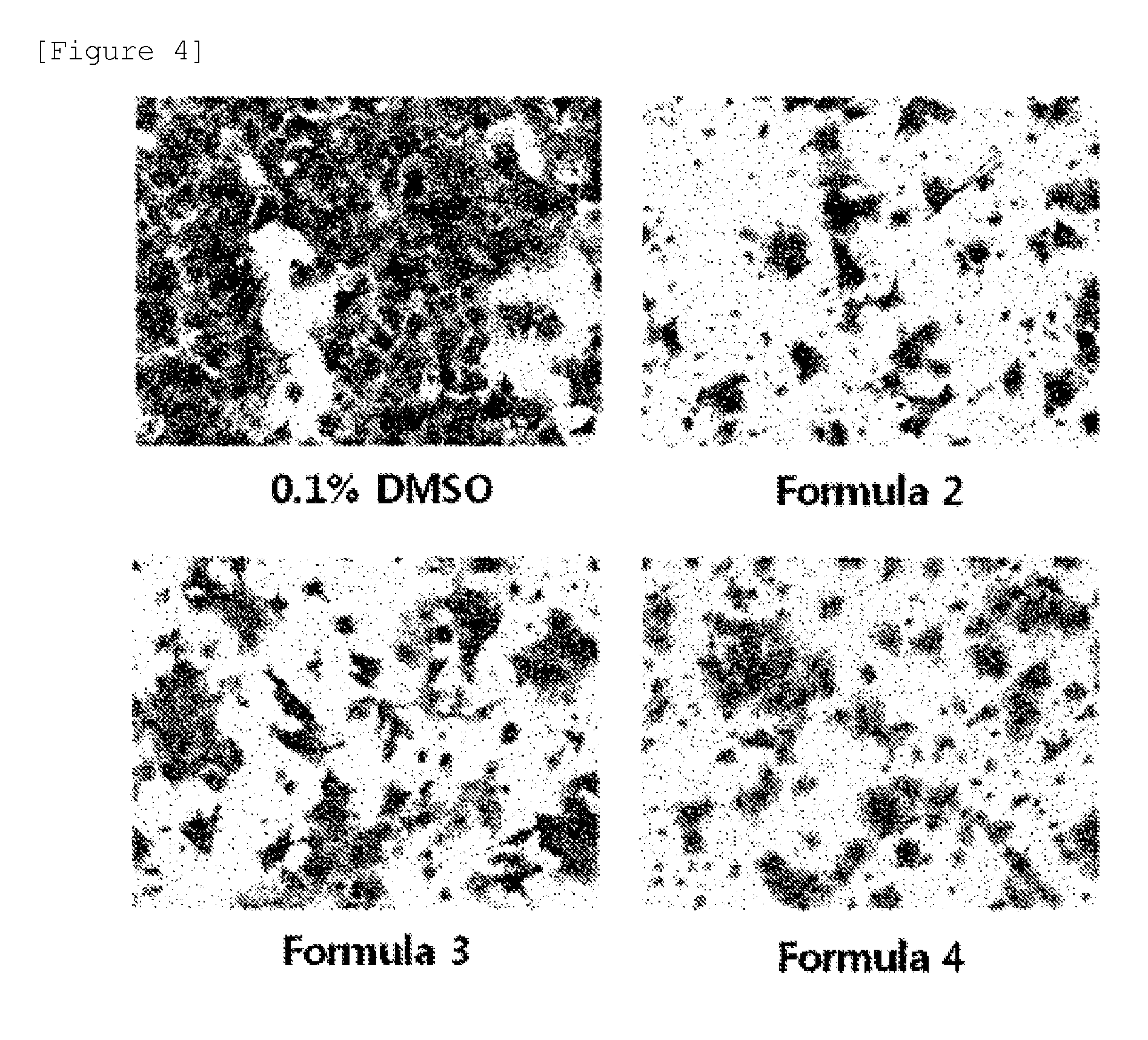 Composition comprising benproperine derivatives as active ingredients for preventing and treating angiogenesis-related diseases