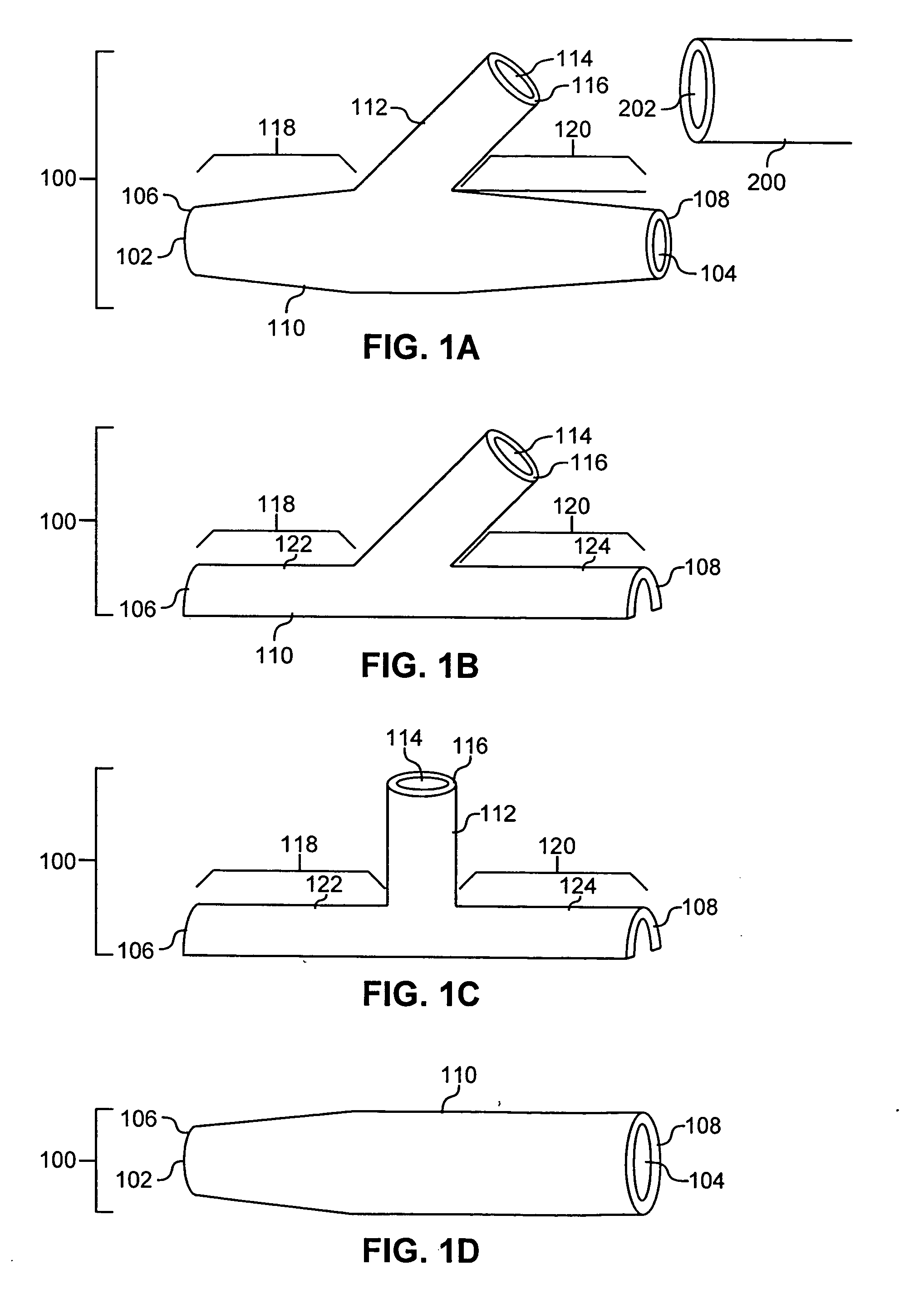 Resorbable anastomosis stents and plugs and their use in patients