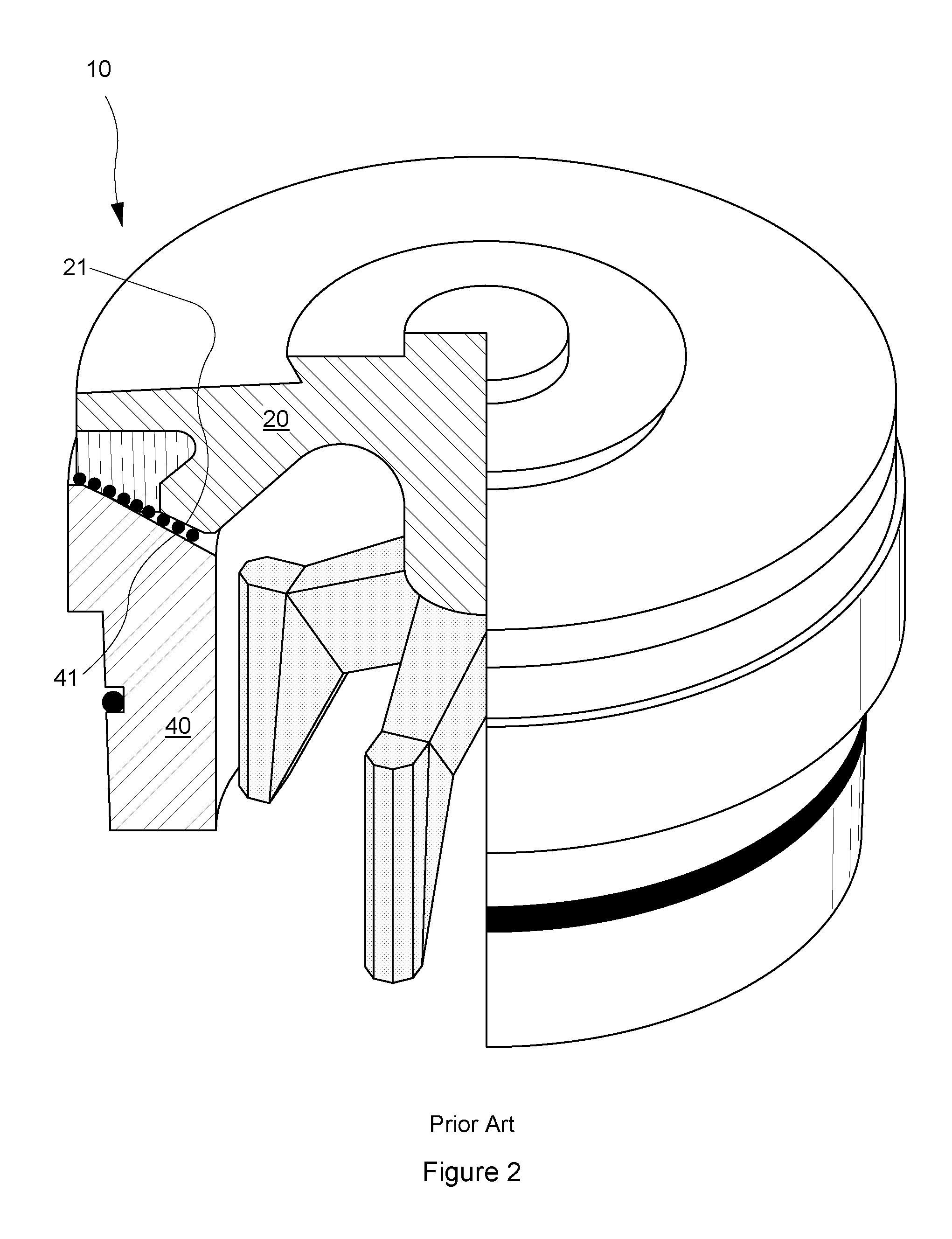 Powdered metal inlay