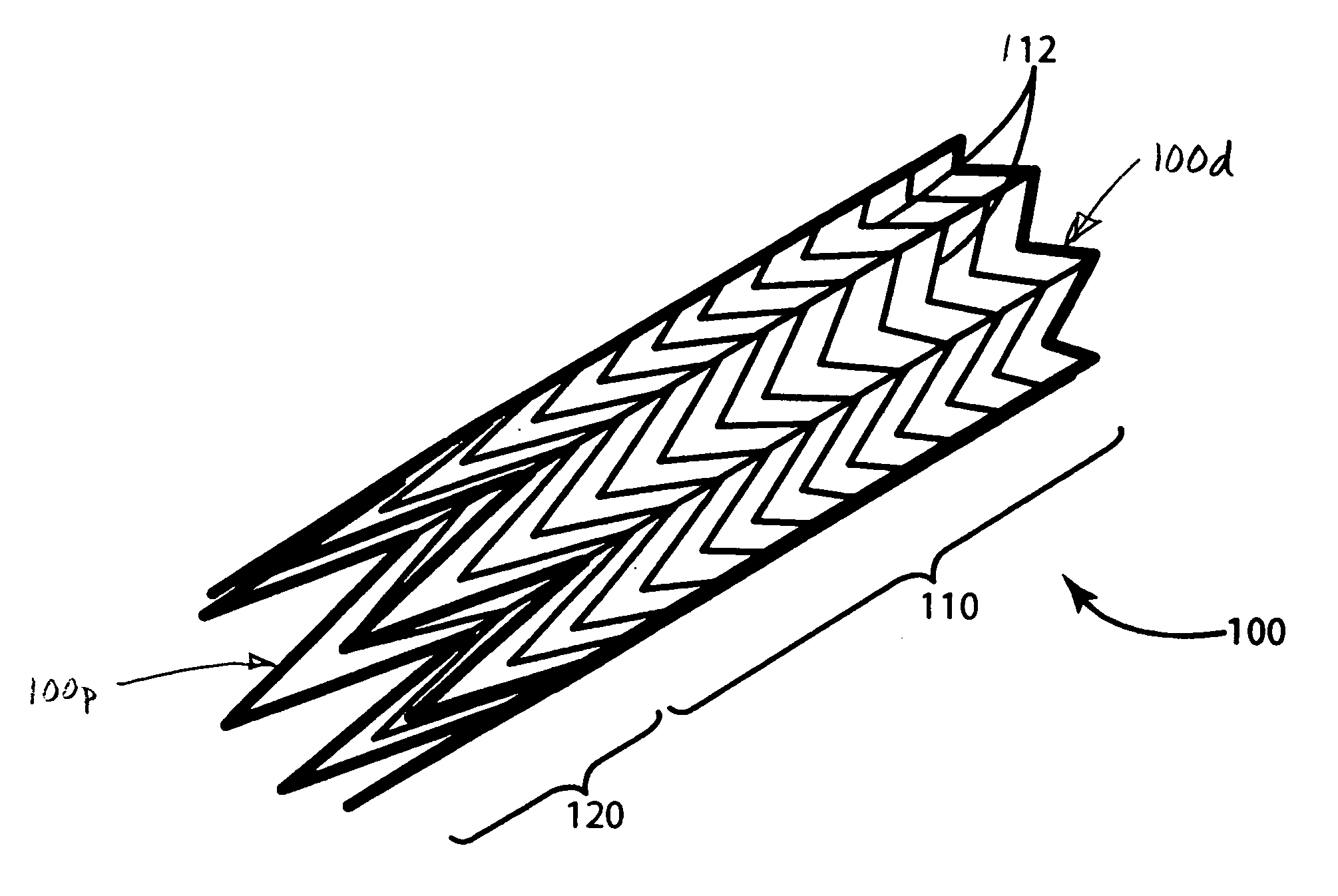 Ostial stent