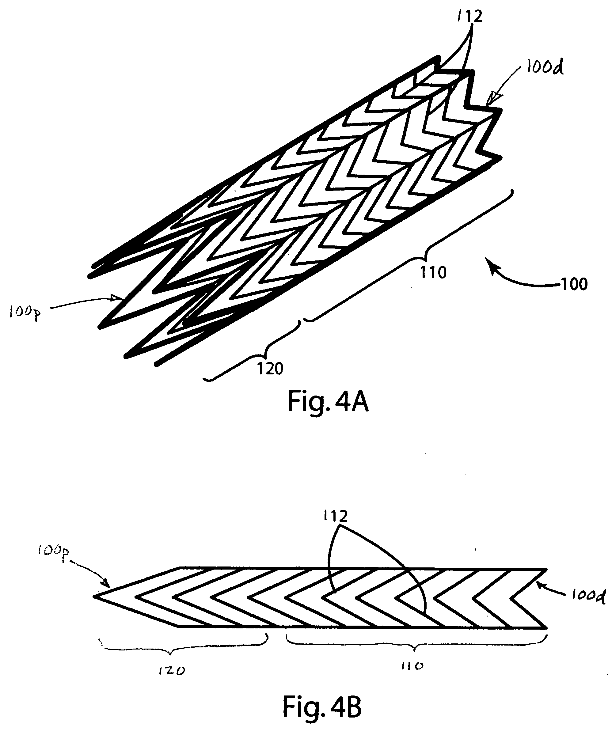 Ostial stent