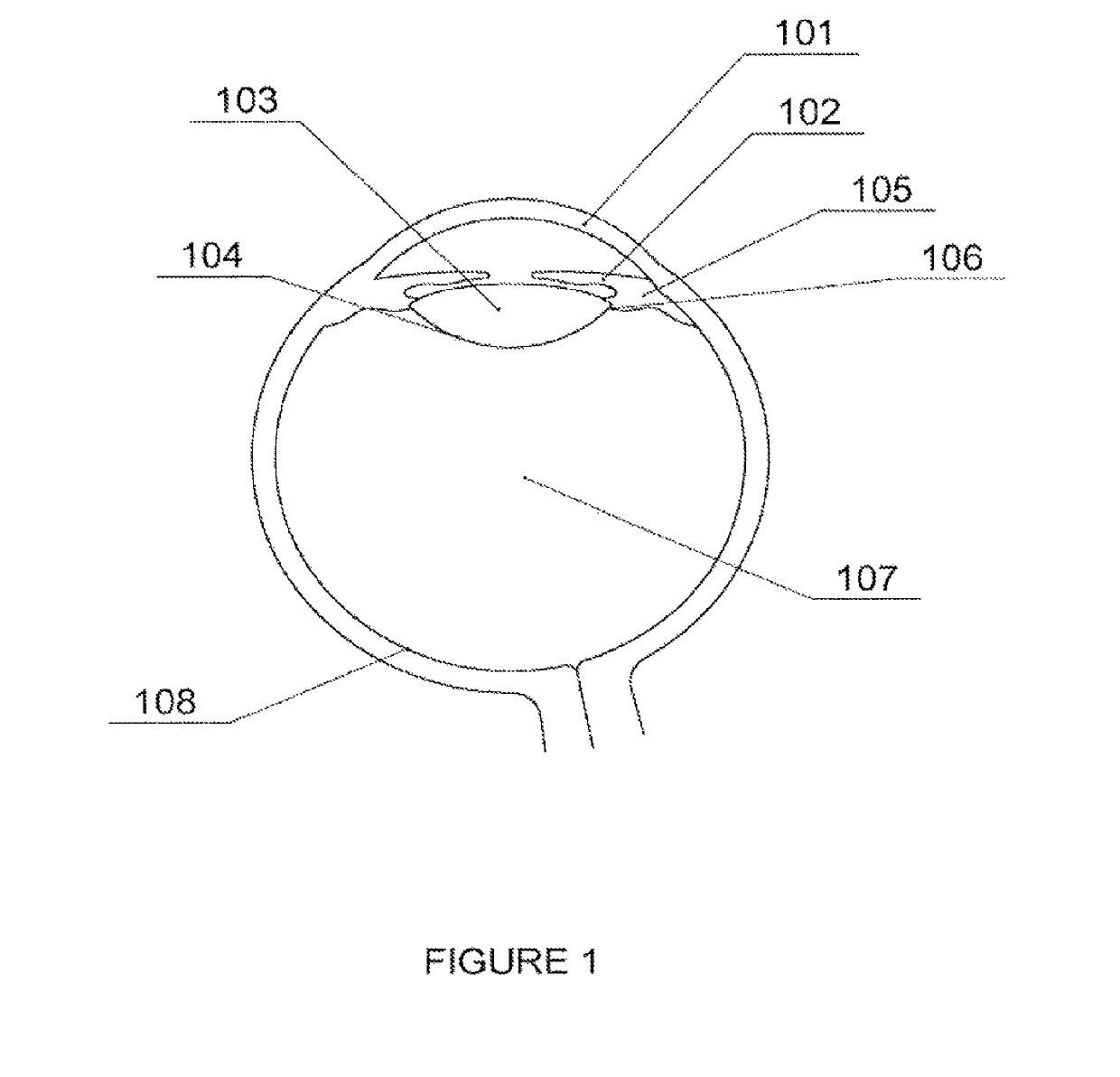 Light-adjustable hydrogel and bioanalogic intraocular lens