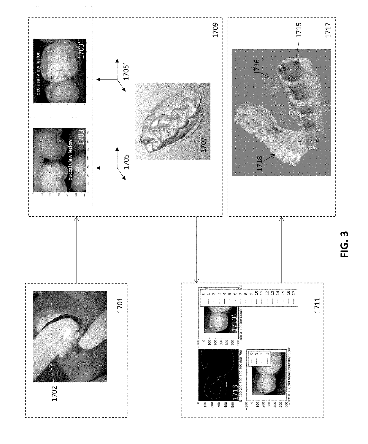 Diagnostic intraoral methods and apparatuses