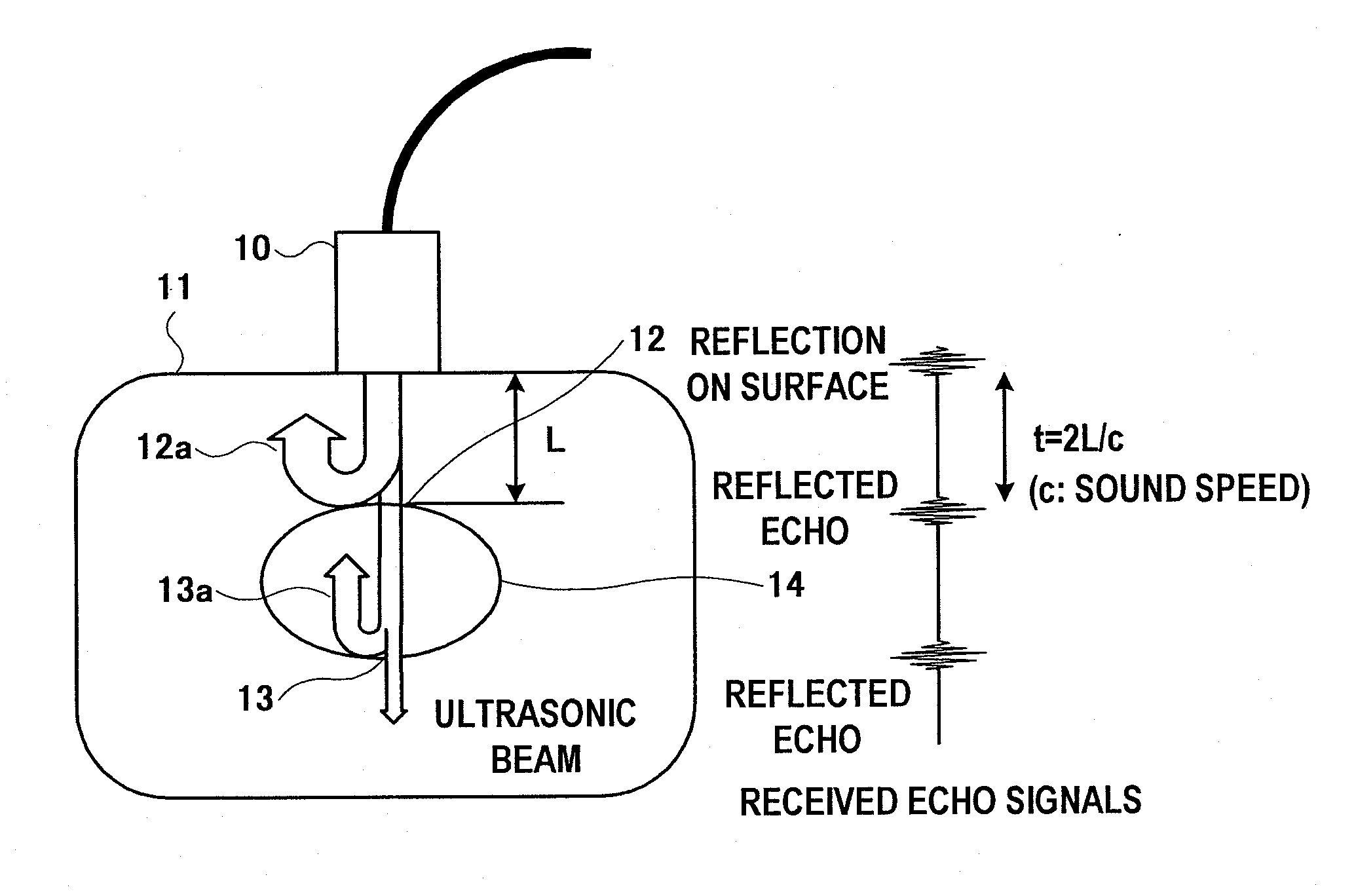 Ultrasonic diagnosis system and distortion distribution display method