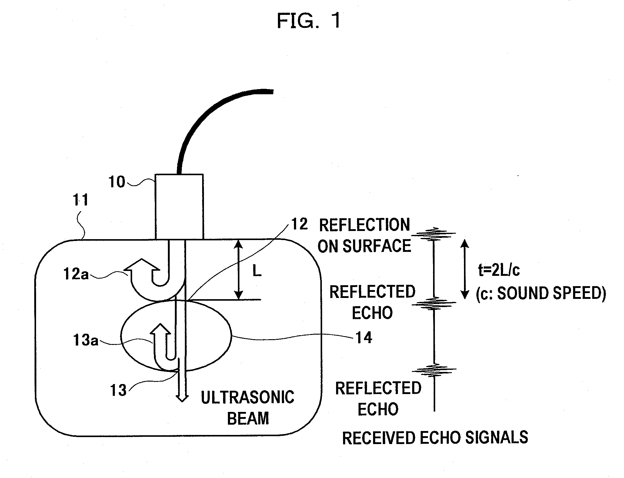 Ultrasonic diagnosis system and distortion distribution display method