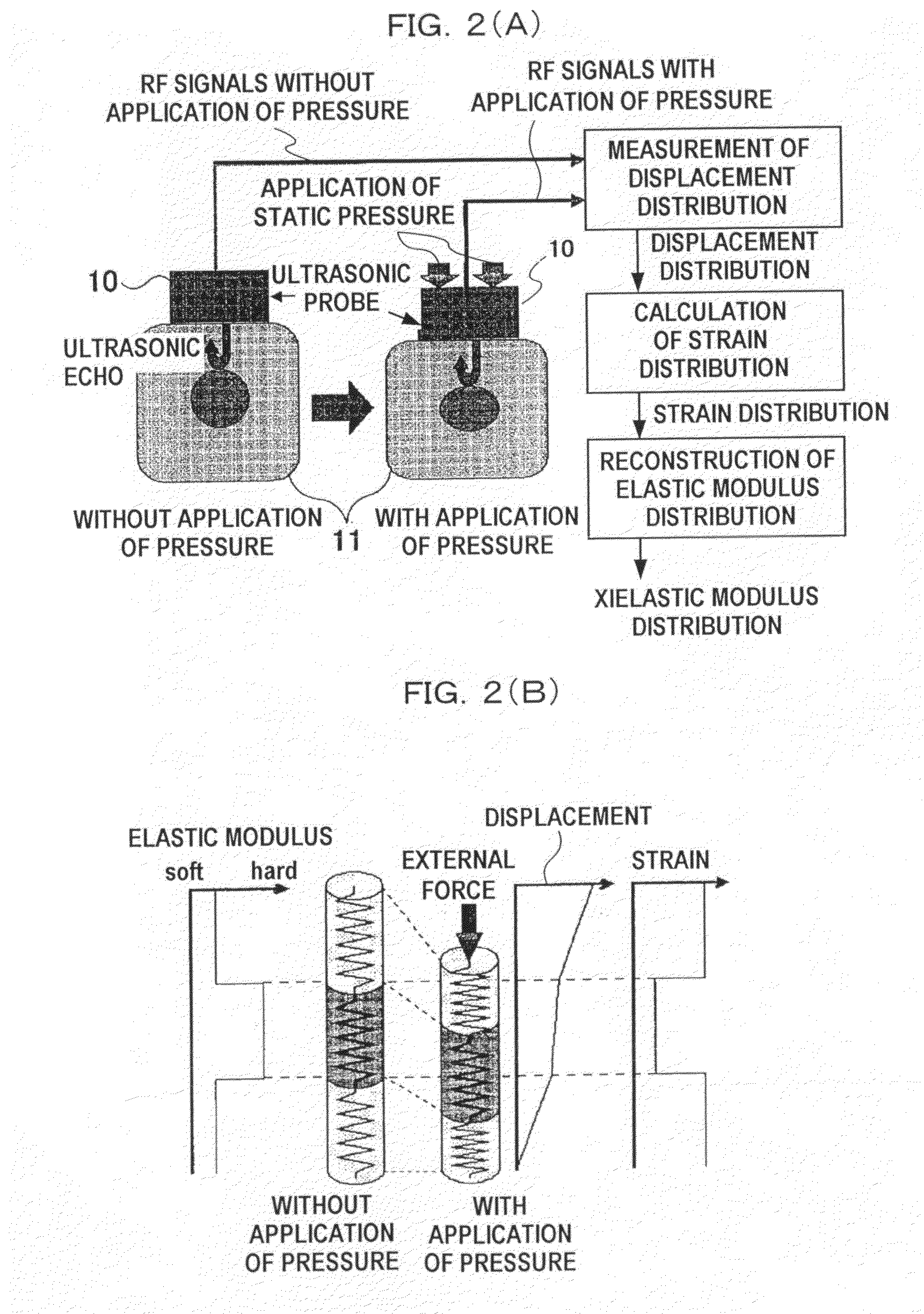 Ultrasonic diagnosis system and distortion distribution display method