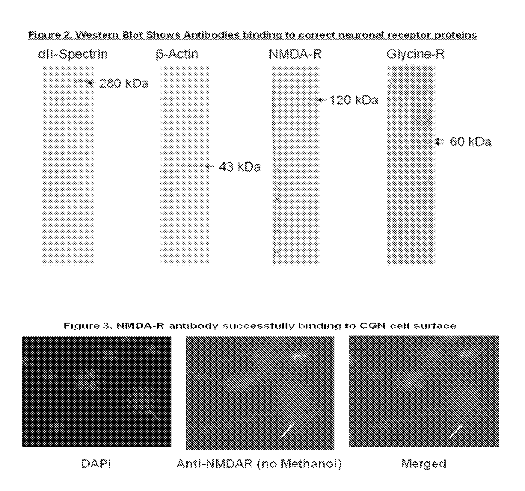 Antibody bound synthetic vesicle containing molecules for deliver to central and peripheral nervous system cells