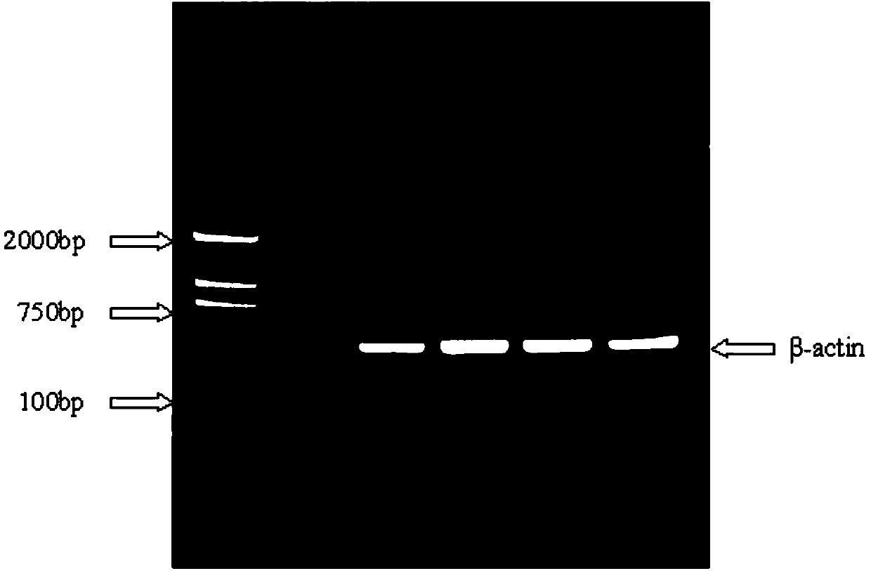 Method for extracting total ribonucleic acid (RNA) of fish testicle tissue