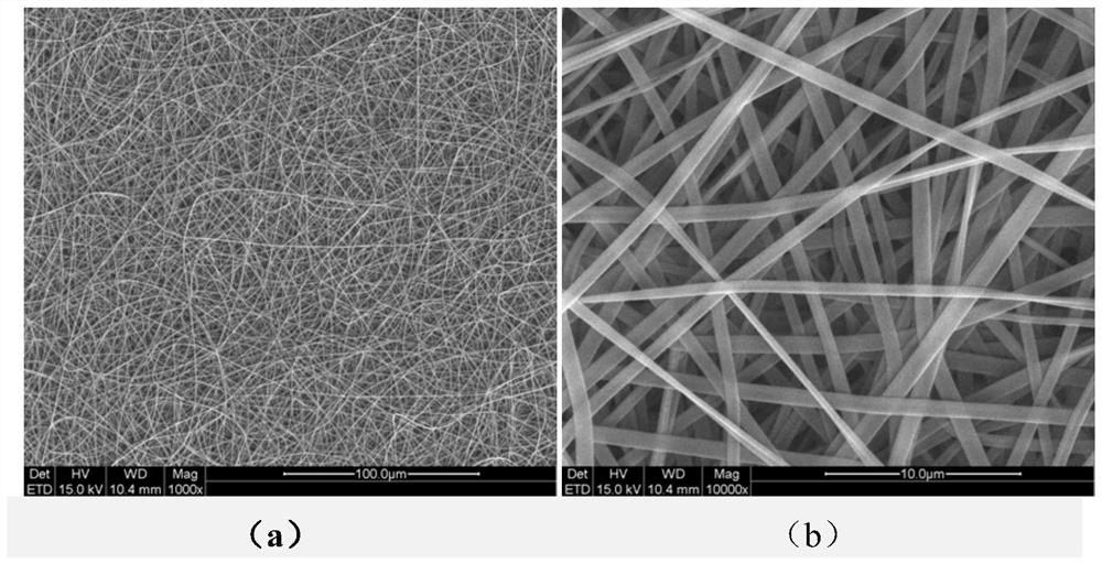 Double-layer guided tissue regeneration membrane and preparation method thereof