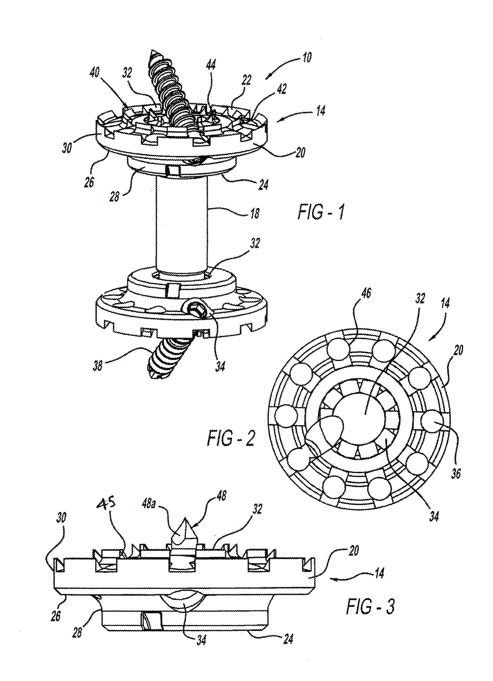 Method and implant device for grafting adjacent vertebral bodies