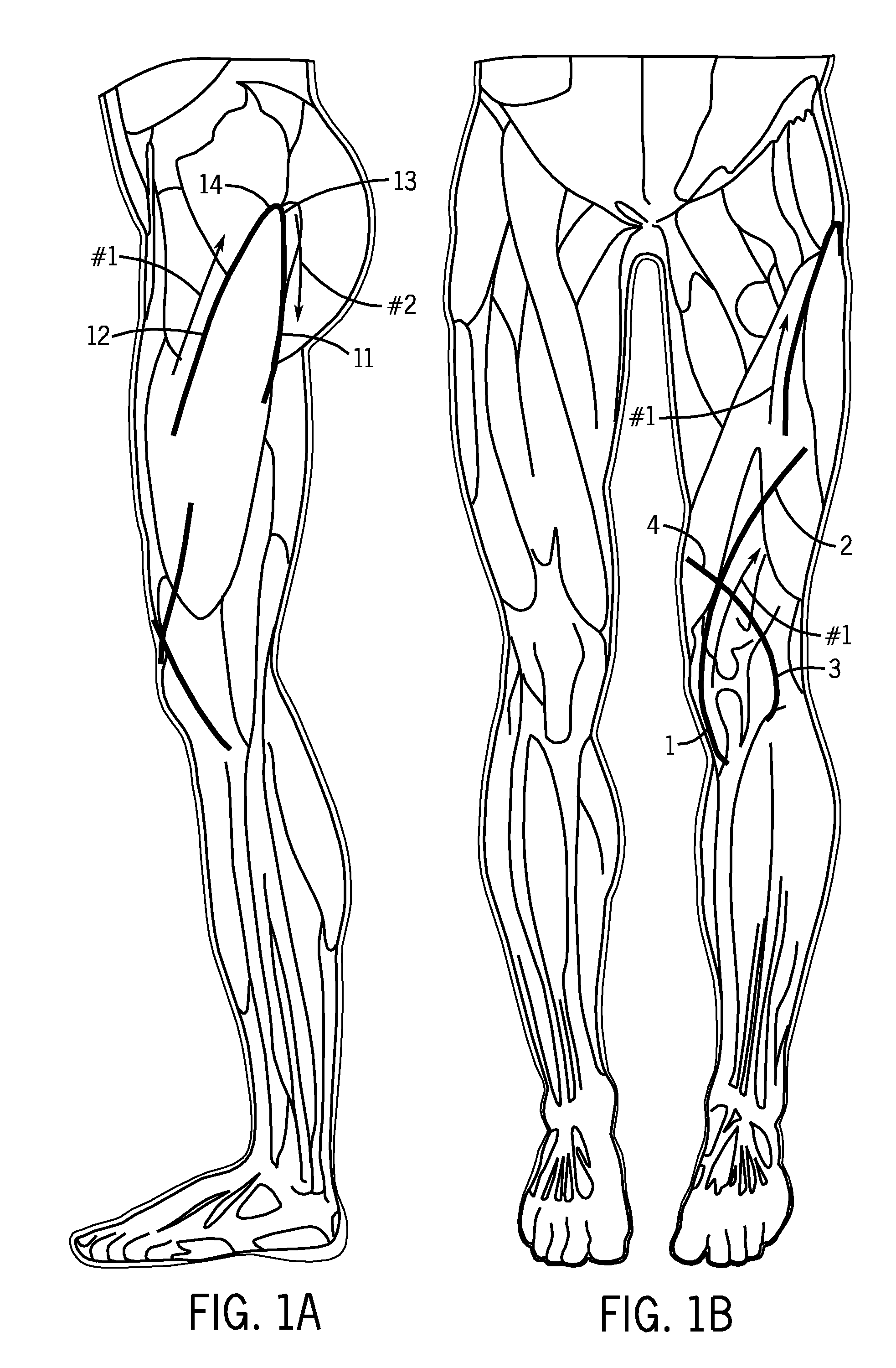 Cutaneous proprioreceptive activation garment system